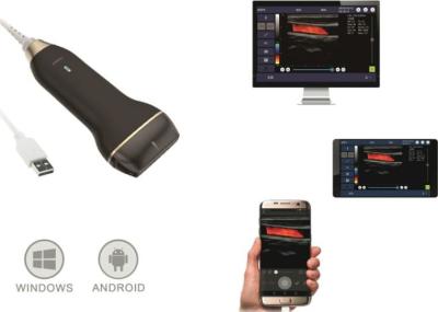 Chine Scanner à la maison d'ultrason de Doppler de couleur de port USB avec 5~10 mégahertz de fréquence à vendre