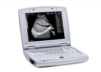 China Ultrasound Scan Machine Portable Ultrasound Scanner with 10.4 Inch LED Monitor for sale