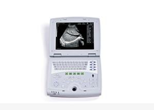 China Mobile Ultrasound Machine Digital Laptop Ultrasound Scanner with 100 Frames Permanent Storage for sale