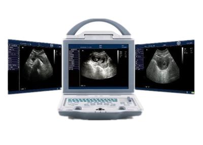 China Varredor portátil do ultrassom da máquina do ultrassom do hospital com os conectores duplos da ponta de prova à venda
