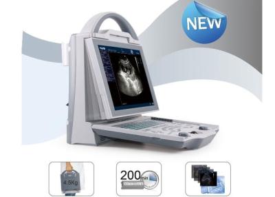 Chine Scanner portatif d'ultrason de scanner mobile d'ultrason avec la sonde convexe linéaire Transvaginal à vendre