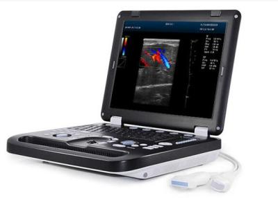 Chine Couleur mobile Doppler de scanner portatif d'ultrason de Digital avec l'écran de 15 pouces LED à vendre