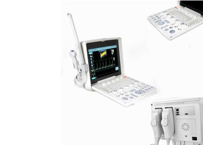 China Varredor portátil do ultrassom da máquina do ultrassom de Digitas com ponta de prova de multi - frequência 2~12MHz à venda