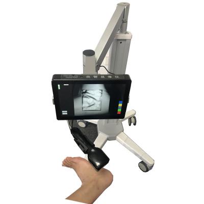 중국 의학 정맥 측정기 안전한 광원 적외선 정맥 측정기 방사선 없이 레이저 없음 판매용