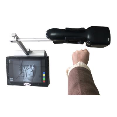 China Portable Economical Infrared Vein Finder Detecting About 10mm Depth of Vein Trolley Available for sale