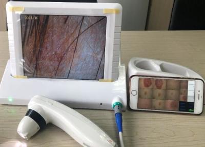 China Digitas Dermatoscope video Handheld com indicação de 8 imagens da tela 1,4,9 da polegada à venda