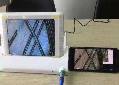中国 デジタル拡大鏡の適用範囲が広いオイルの湿気の顔料のデータ レポートを用いる手持ち型のビデオDermatoscopeの皮の検光子 販売のため