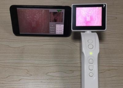 China Handheld Digital Dermatoscope Video Dermatoscope Wifi Connection to Mobilephone 3.5 Inch Screen for sale