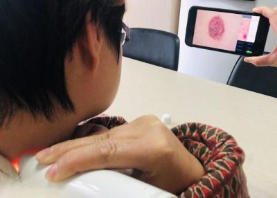 China El análisis video de la piel y del cuero cabelludo de Dermatoscope del aparato médico trabaja a máquina la resolución de imagen 1280*720 en venta