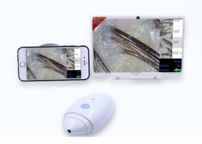 China Digital Handheld Dermatoscope Video Skin Analyzer Resolution of 1080P with Internal Lithium Battery for sale