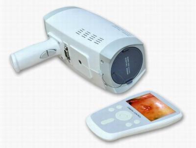 China Colposcope eletrônico de Digitas dos pixéis da definição 800000 da lente com o obturador eletrônico automático tela Handheld de 3,5 polegadas à venda