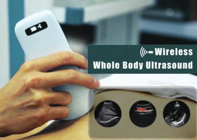 China elektronischer Digital-Ultraschall-Scanner der Reihen-3.6Mhz für den Unterleib Herz zu verkaufen