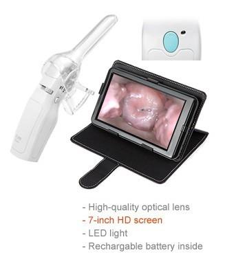 China Vaginal Camera for Women Care Digital Mini Colposcope 1.5 Times Magnification 10cm Observation Distance for sale