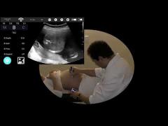 BIO-W8C with convex transducer scanning pregnency