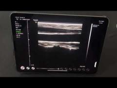 BIO-W3 BW Linear Probe scans Carotid Artery