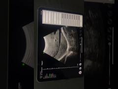 BIO-W3 B/W Convex probe scans Liver