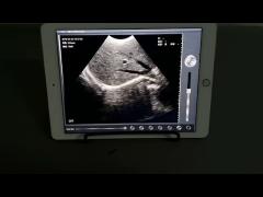 BIO-W3 scans liver