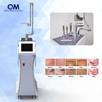 China Laser CO2 Fractional Skin Resurfacing RF Metal Tube Medical Acne Scars Removal CO2 Fractional Laser Vaginal Tightening Machine for sale