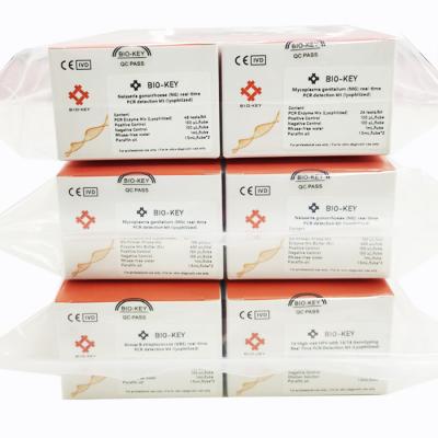 China Epstein Barr Virus EBV Real Time PCR Detection Kit Lyophilized 96tests/Kit for sale