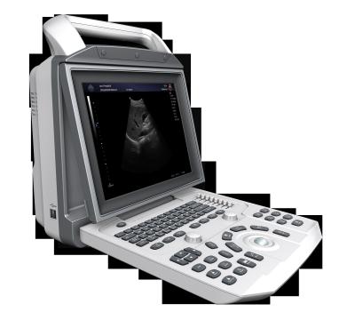 China Portable Black & White Ultrasound Machine For Pregnancy Test portable ultrasound machine for pregnancy for sale