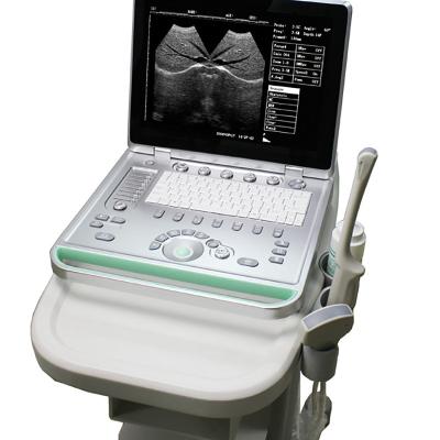 China 1 Probes Portable Laptop Ultrasound Machine 2.0MHz ~ 10MHz 15 Inch LCD Screen for sale
