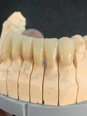 China OEM Translucent Dental Zirconia Blank 3D Pro Dental Zirconia Block for sale