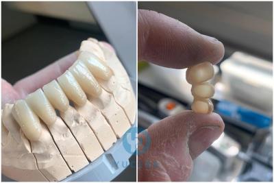 China CAD CAM Translucent Zirconia Crowns 98mm HT Zirconia Blank Disc for sale