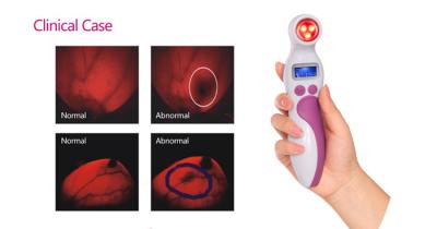 Chine Essai infrarouge portatif de cancer du sein de femmes à la maison pour détecter le cancer du sein à vendre