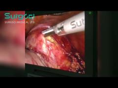 Using the SurgSci Ultrasonic Scalpel in Laparoscopic Total Hysterectomy