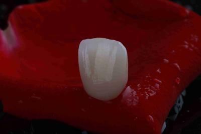 China Natural Gradient 3D Multilayer Dental Zirconia Block for sale