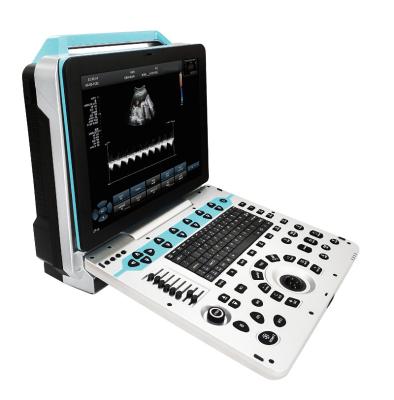 Chine système portatif de machine de balayage de Doppler d'ultrason de couleur de 3D 4D 5D à vendre