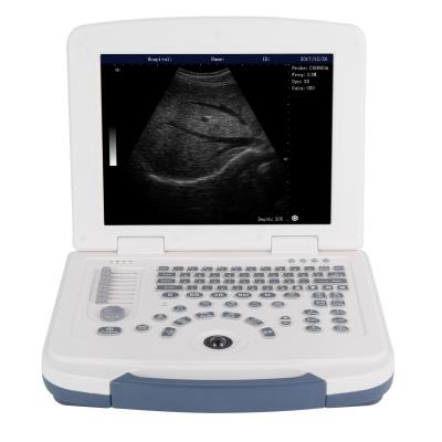 Chine Plein scanner d'ultrason de Digital de l'ordinateur portable B W de machine portative d'ultrason à vendre