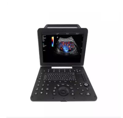 Chine Machine portative de scanner d'ultrason de Doppler de couleur de Figital de cardiologie cardio-vasculaire pleine à vendre