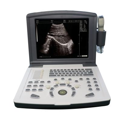 China Portable Full Digital Diagnostic Ultrasound scanner OEM for sale