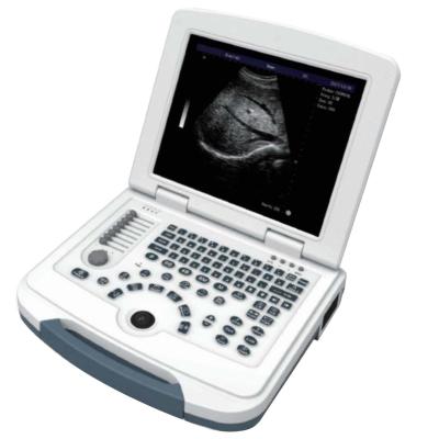 China Laptop Portable Color Dopler Ultrasound Machine Full Digital Portable B/W Ultrasound Scanner for human for sale