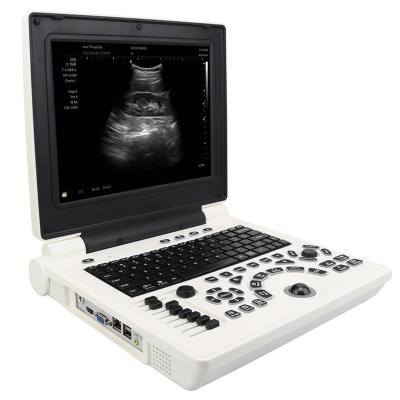 China Clinic Hospital OB/GYN Laptop Portable Ultrasound System Price of Ultrasound Machine for sale