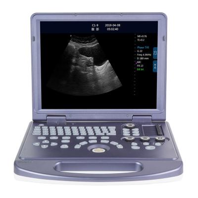 China Best Sale Maquina de Ultrasonido Full Digital Laptop B/W Ultrasound Machine Te koop