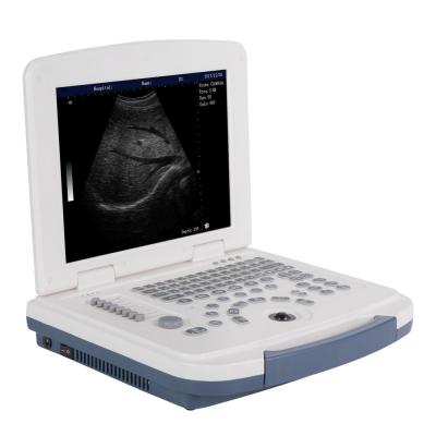 China Laptop Full Digital B/W ultra sound machine for pregnancy for sale