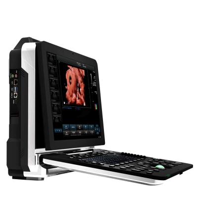 China Color Doppler Ultrasound Scanner Machine Portable With 256 Image à venda