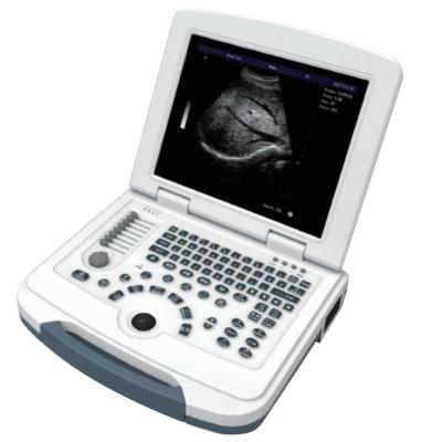 China Full Digital Wireless Ultrasound Machine Operating Room Supplies For Human en venta