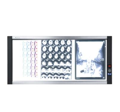 China LED Hospital X Ray Machine Electric Plastic Medical Film Viewer for sale