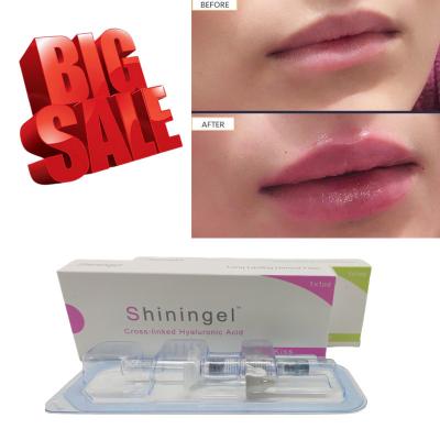 China 2ml Deep High Purity Hyaluronic Acid Lip Fillers For Nasolabial Folds for sale