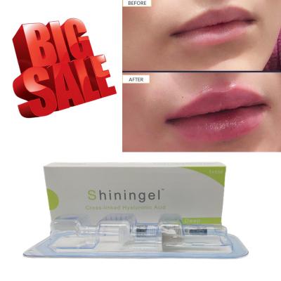 China CE 24mg/Ml Anti Aging Hyaluronic Acid Lip Fillers Deep OEM ODM for sale