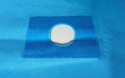 China SMS Coated Sterile Aperture Drape Medical Disposable Surgical With Hole for sale