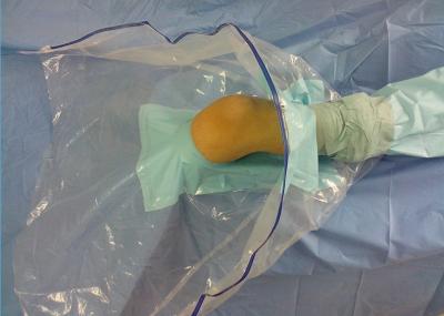 Chine Le patient jetable d'Arthroscopy de genou drape la classe orthopédique d'extrémité inférieure II à vendre