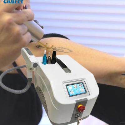 China 1064nm 532nm 1320nm Q Switch Nd YAG Máquina de remoção de tatuagens a laser com peeling de carbono à venda