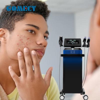 中国 GOMECY Fractional Skin Treatment with Microneedle RF Machine for Safe Wrinkle Removal 販売のため