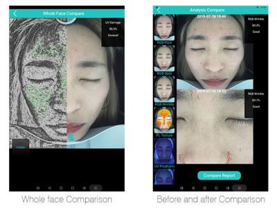 China 3d Moisture Portable Facial Skin Analyzer Machine / Skin Hydration Analyzer for sale
