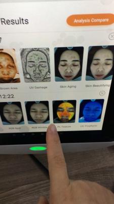 China Therapist Smart Skin Analyzer Detect Deep Skin Problem  Ce Certificate for sale