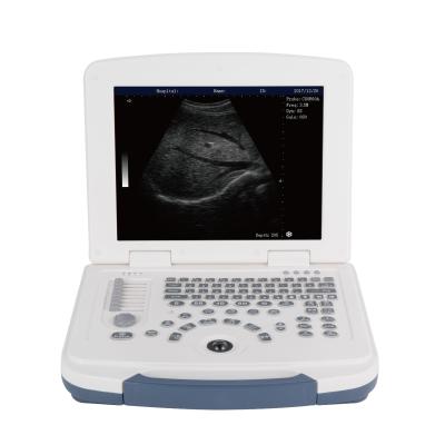 China BW Laptop Ultrasound Machine Full Digital Ultrasound Scanner GH580 for sale